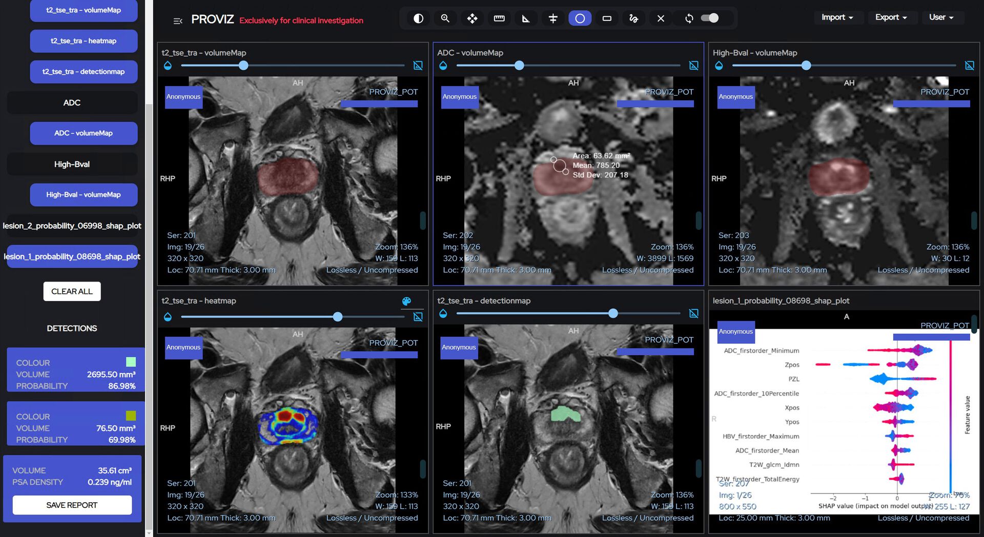 Screen-shot from the Proviz decision support tool showing the detection of a lesion in one of the men referred to the prospective proof of technology study